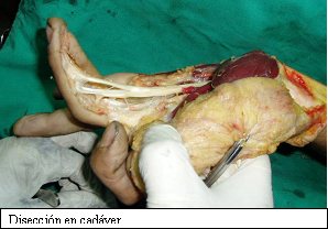 Anatomia de la mano tendones